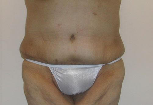 1576483991_after.jpg