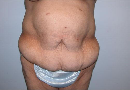 1576483991_before.jpg