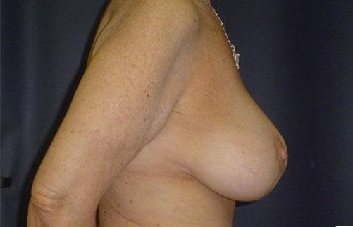 1576490107_after.jpg