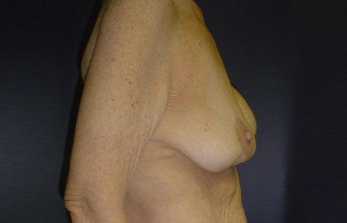 1576490107_before.jpg