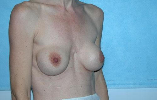 1576490845_before.jpg
