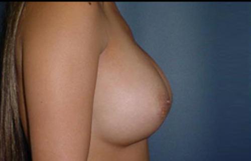 1576491483_after.jpg