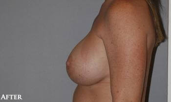 1576497908_after.jpg
