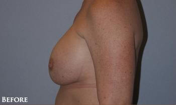 1576497908_before.jpg