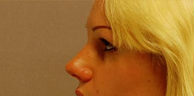 1576652912_after.jpg