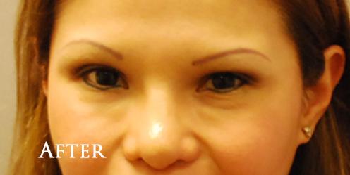 1576654869_after.jpg
