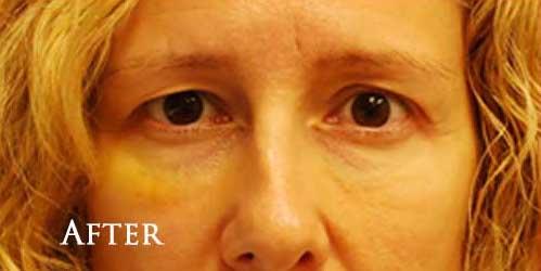 1576654964_after.jpg
