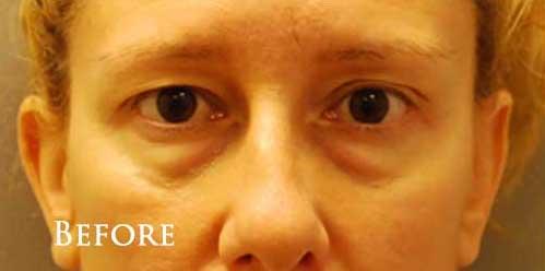 1576654964_before.jpg