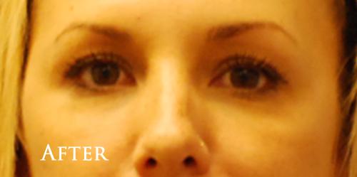 1576655991_after.jpg