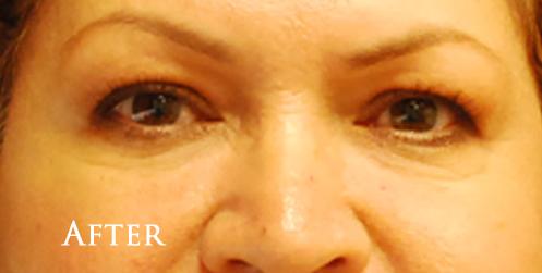 1576656226_after.jpg
