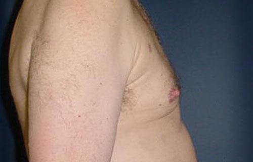 1576666915_after.jpg