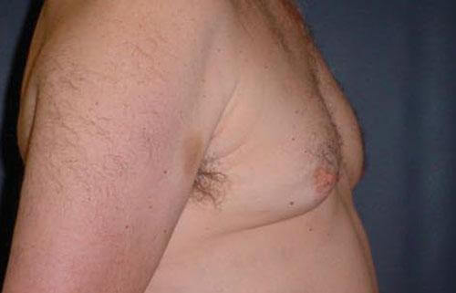 1576666915_before.jpg
