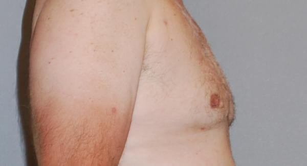 1576667023_after.jpg