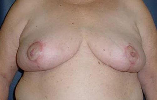 1576668065_after.jpg