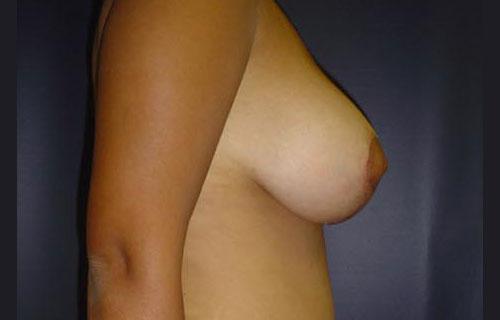 1576749196_after.jpg