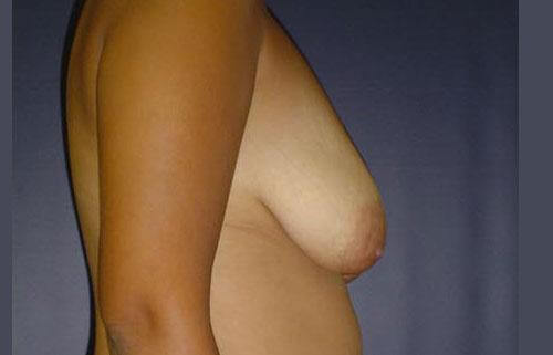 1576749196_before.jpg