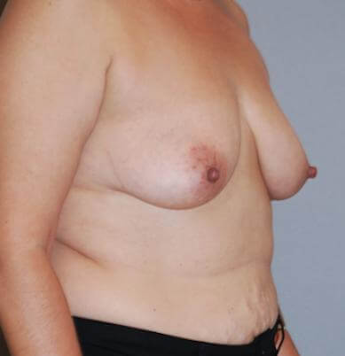 1576749546_before.jpg