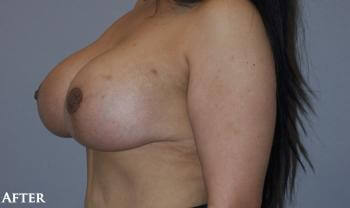 1576749820_after.jpg