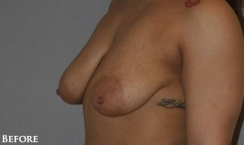 1576749972_before.jpg