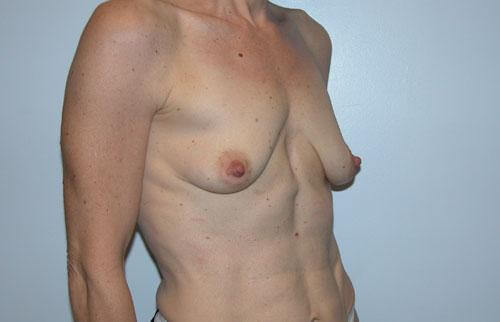 1576752096_before.jpg