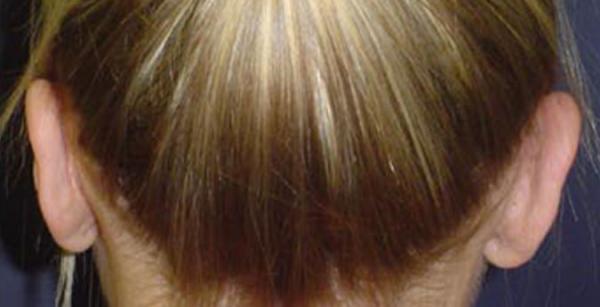 1577081915_after.jpg