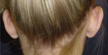 1577081915_before.jpg