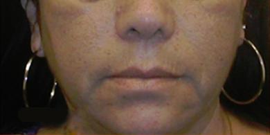 1577086596_after.jpg