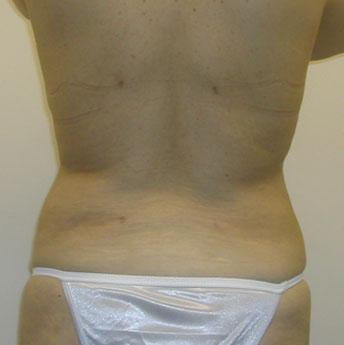 1577106570_after.jpg
