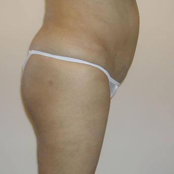 1577107034_after.jpg
