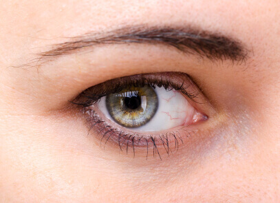 eyelid-surgery