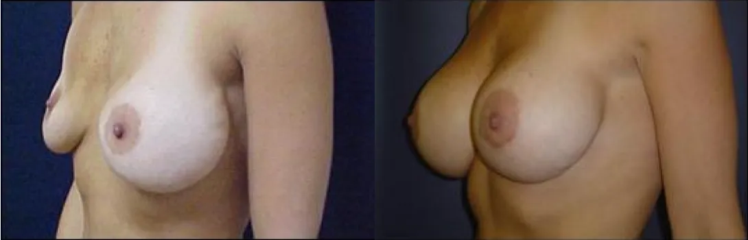 Case 827_2