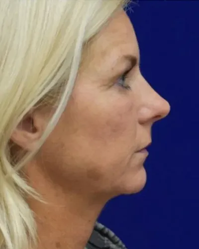 C1-3