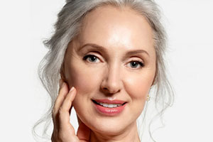 Natural mini facelift result with Dr. Mashhadian in Beverly Hills